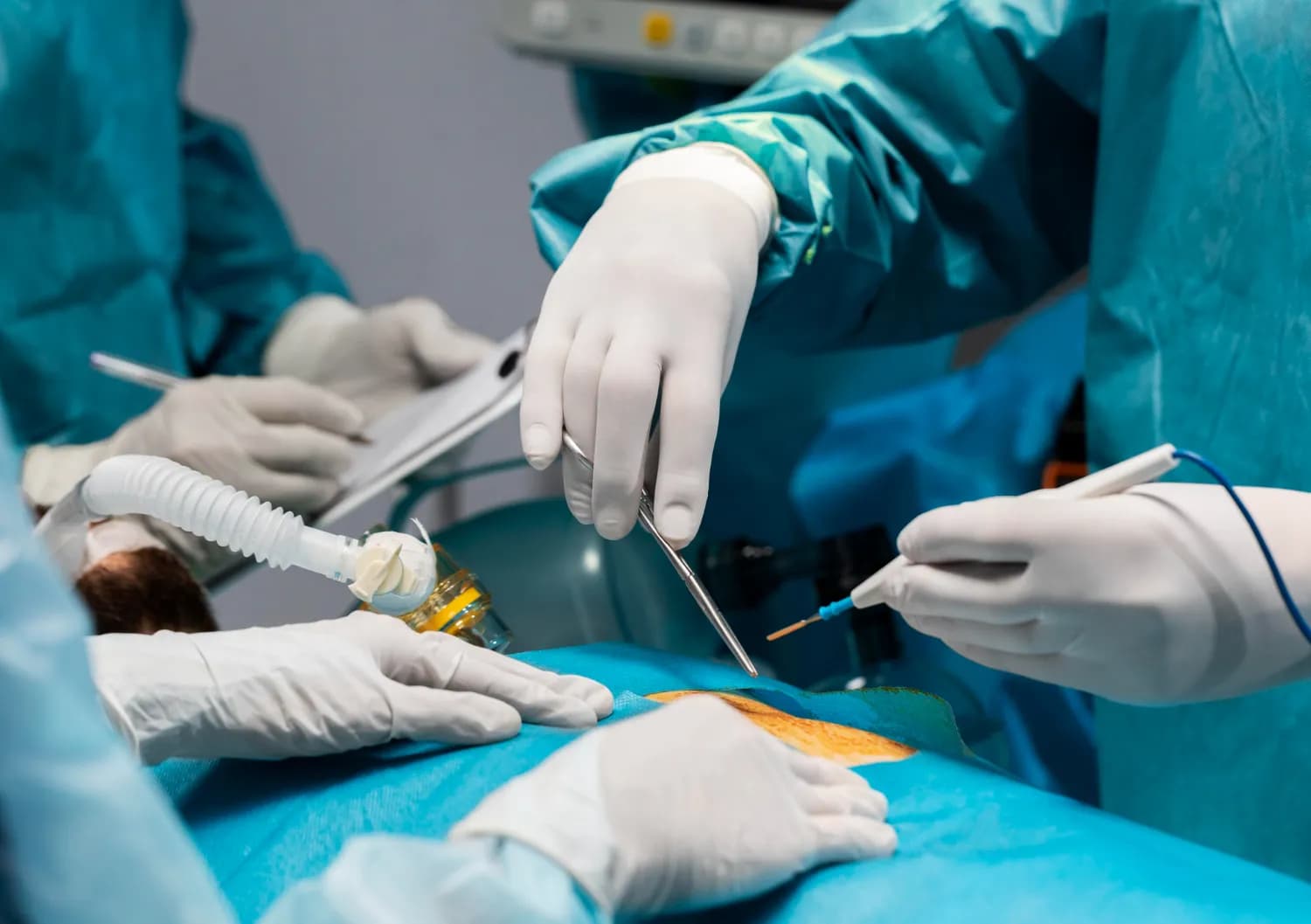 Obesity Surgery Case Study
