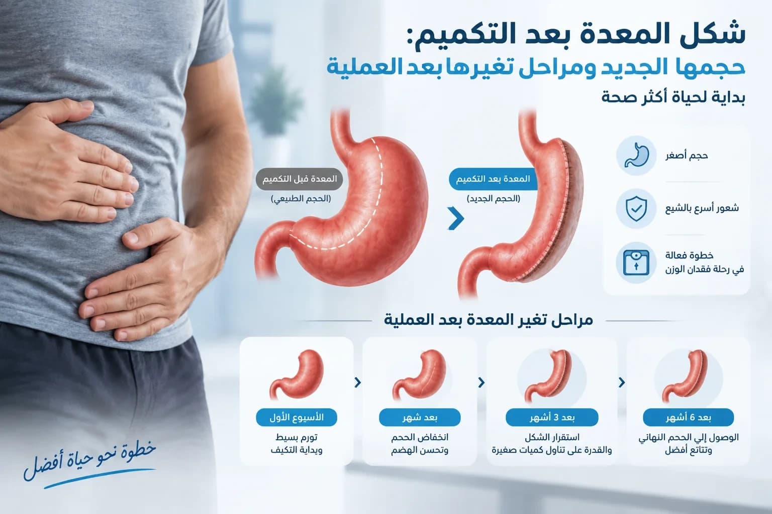 شكل المعدة بعد التكميم: حجمها الجديد ومراحل تغيرها بعد العملية